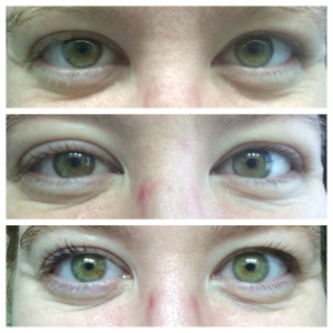 Crow's Feet & eye wrinkles change over a month of using L'Oreal Revitalift Eye Cream